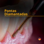 Pontas Diamantadas