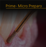 Prime micro preparo