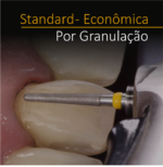 STANDARD Econômica- Por granulação