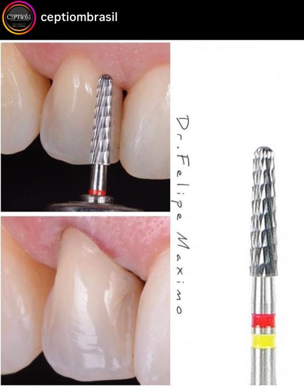 Broca Multilaminada Ceptiom 12 Lam. Preparo de Coroas e Remoção de Resina M10.314.018 - 199 - Imagem 2