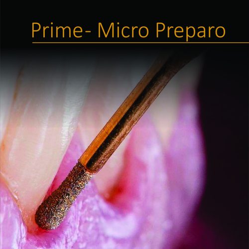 Micro preparos - Lentes e Facetas